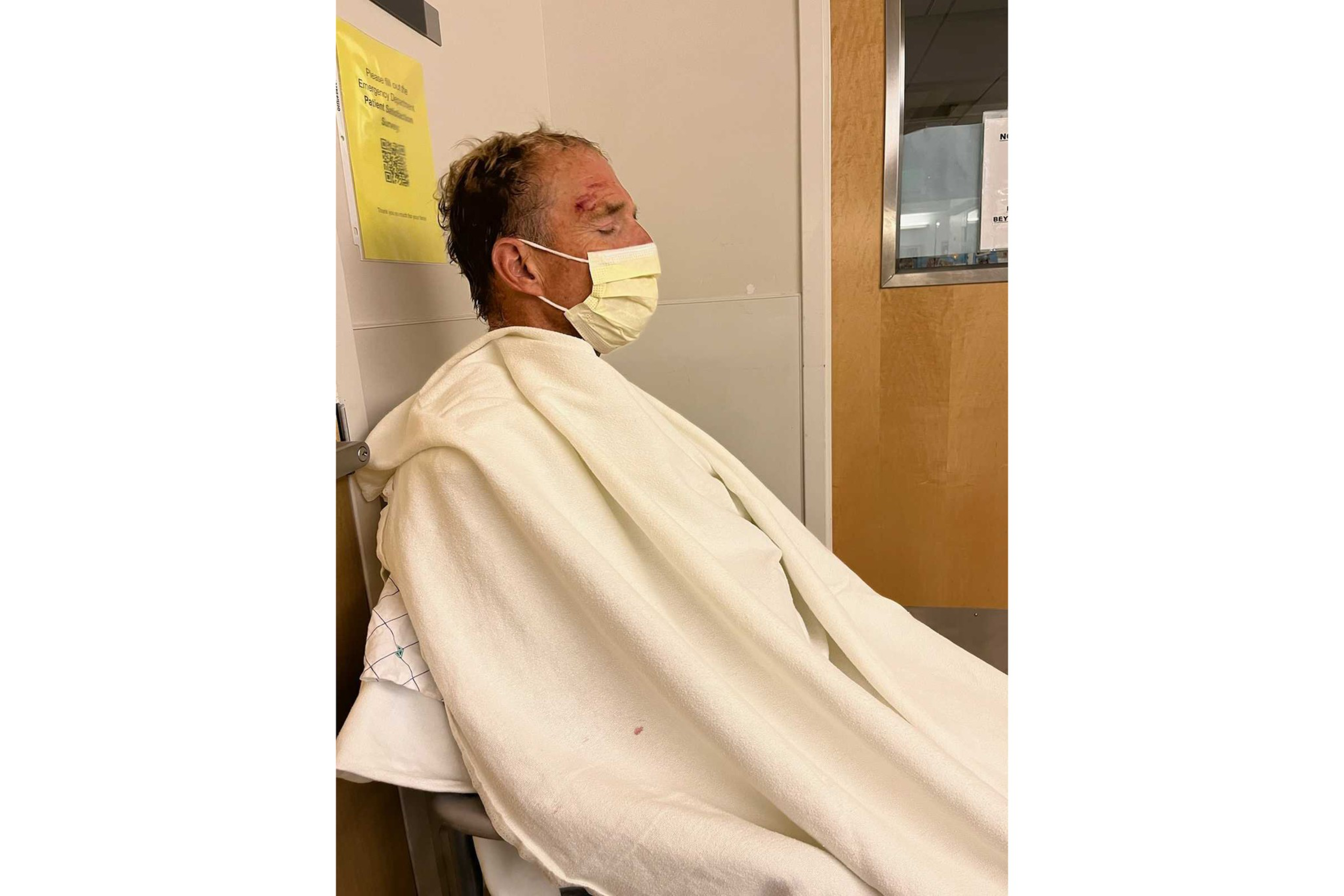 A man with visible head injuries sits in a chair, wearing a face mask and covered in a white hospital blanket inside a medical facility.
