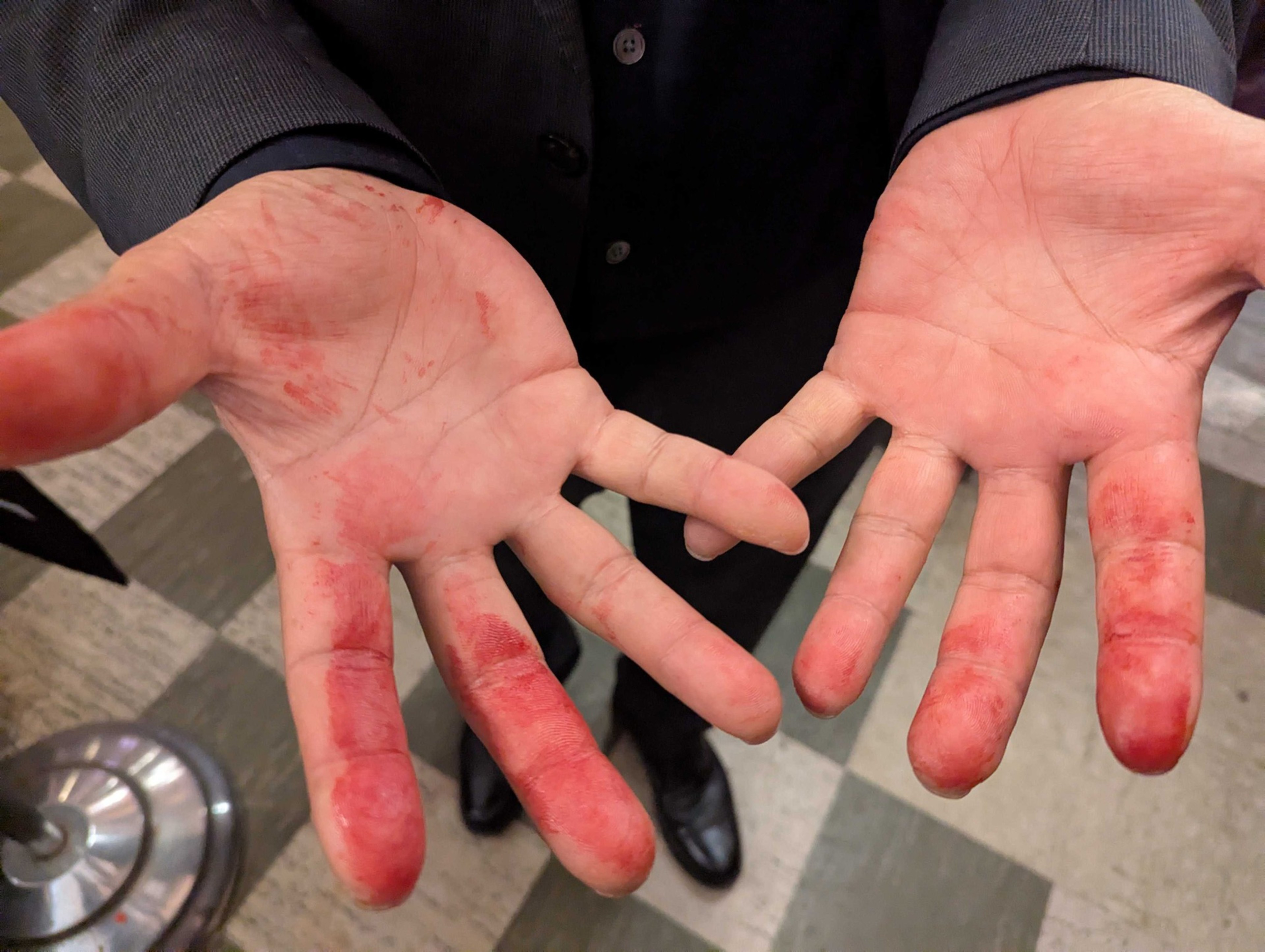 A person in a suit shows their open hands, which are stained with red, resembling color or dye on the fingers and palms, standing on a tiled floor.