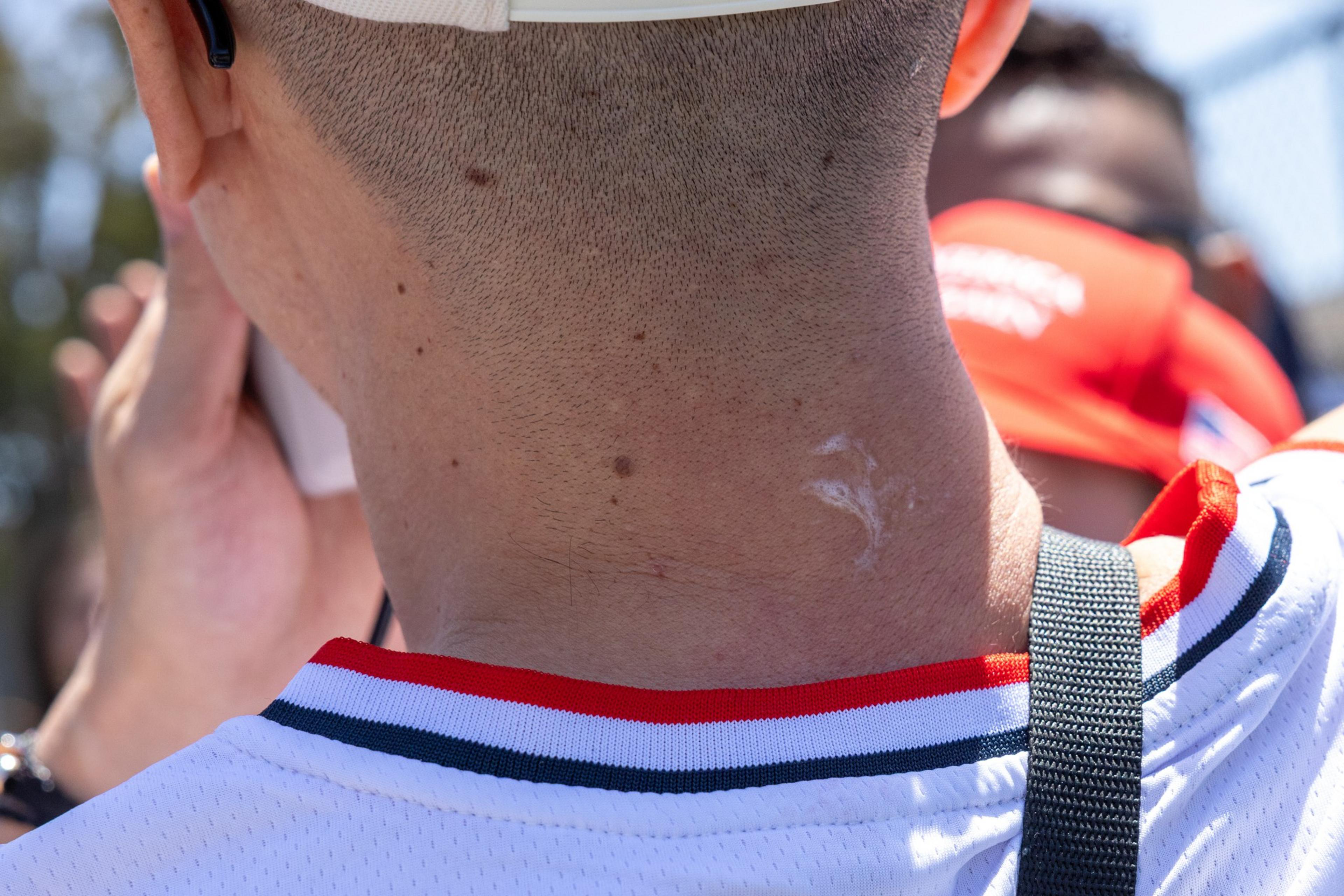 A person with short hair wears a white jersey with red and black trim. There's a strap over the shoulder and a small patch of white on the neck.