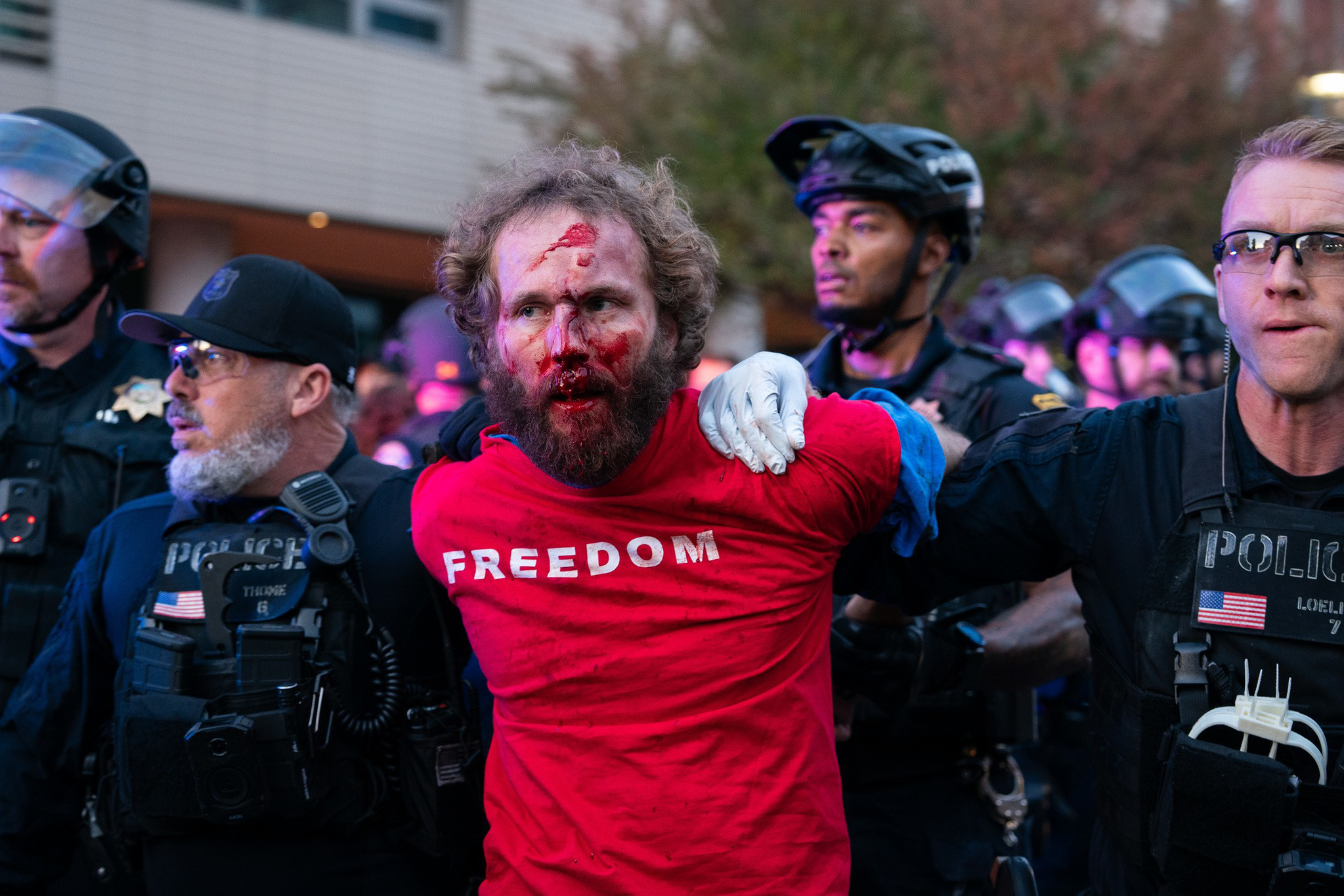 A man with a bloodied face wearing a red "FREEDOM" shirt is being held by multiple police officers in helmets and tactical gear.