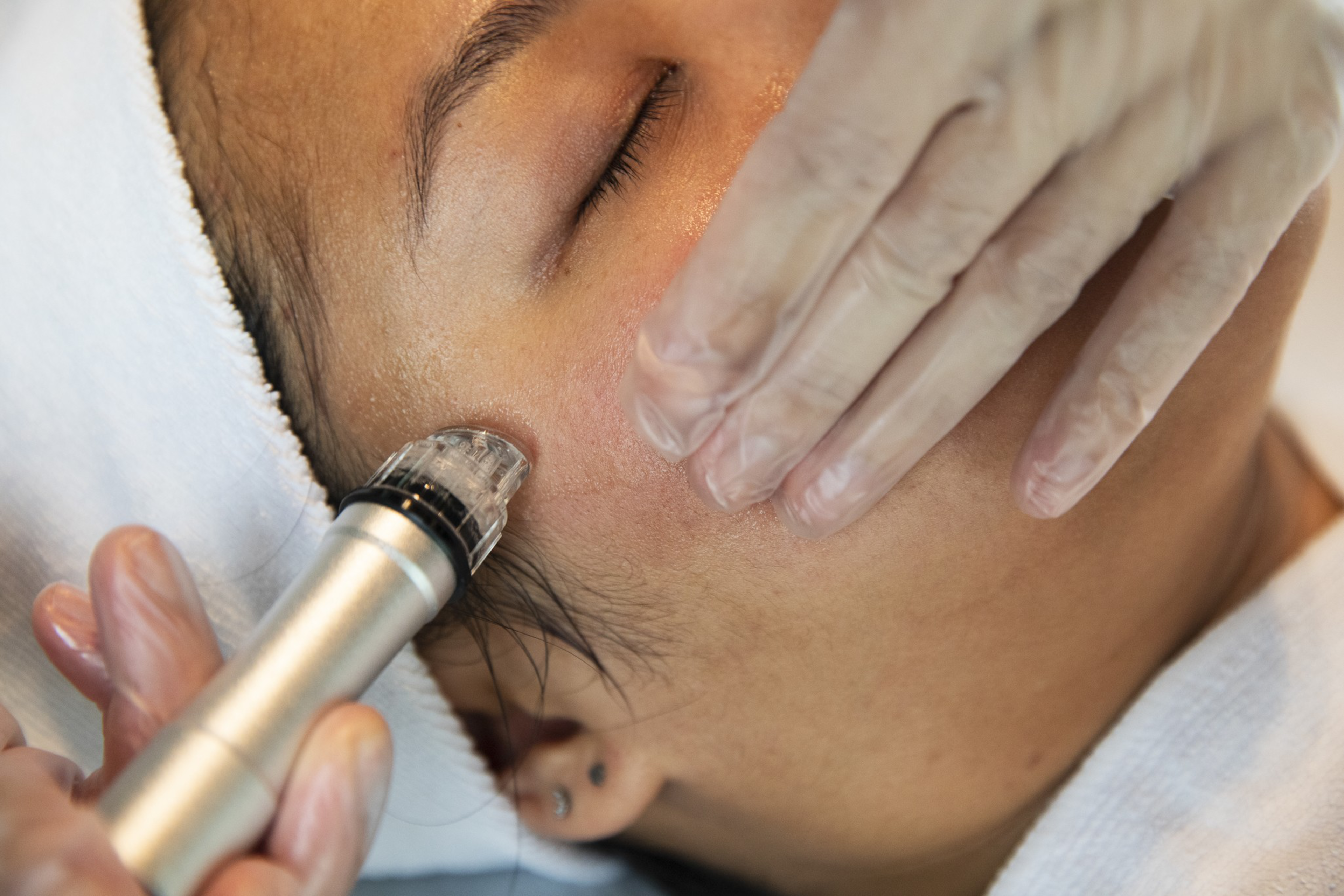 A person is receiving a facial treatment where a gloved hand holds a device against their cheek while the person’s eyes are closed.