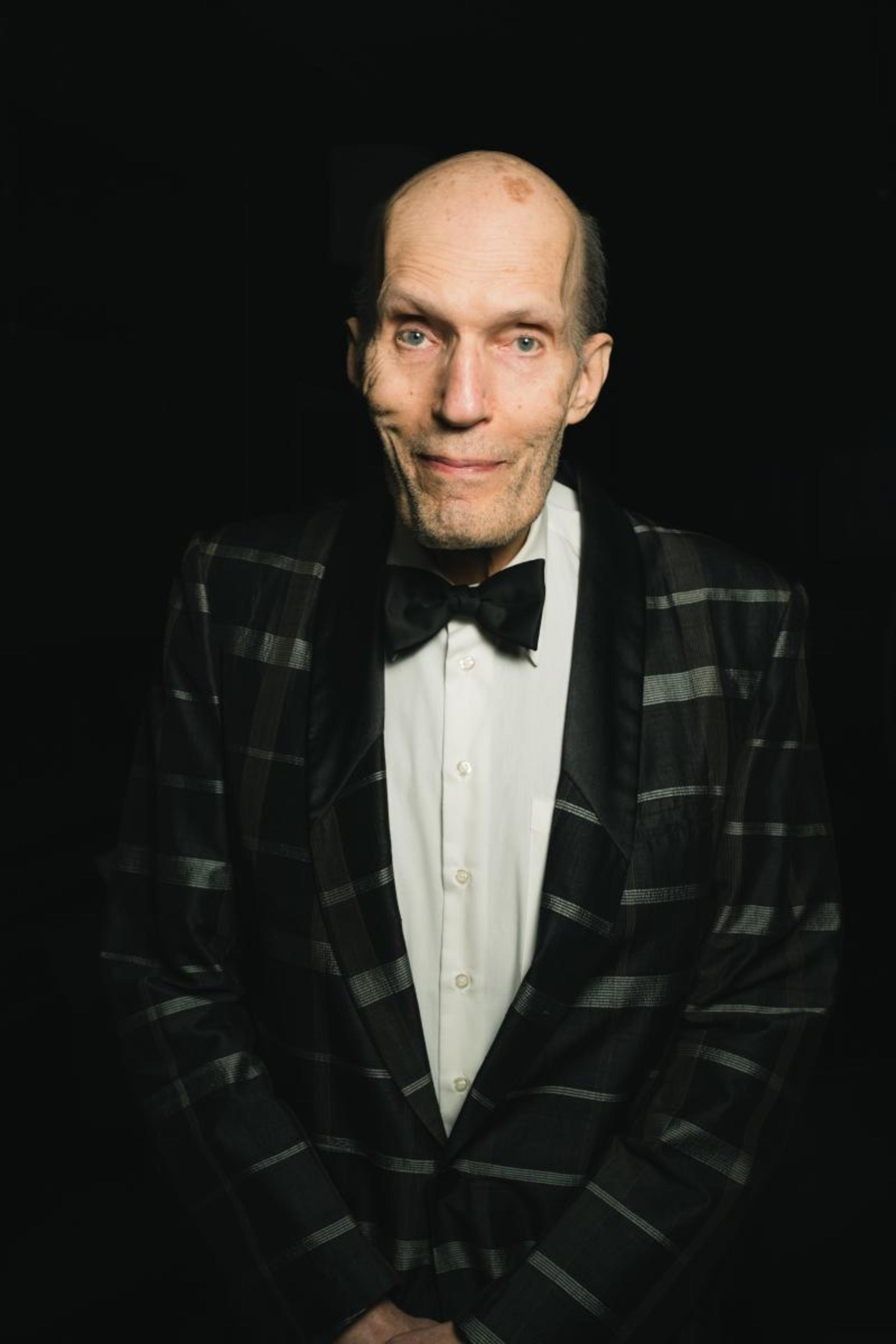 A man in a checkered suit and bow tie stands against a dark background, smiling slightly.