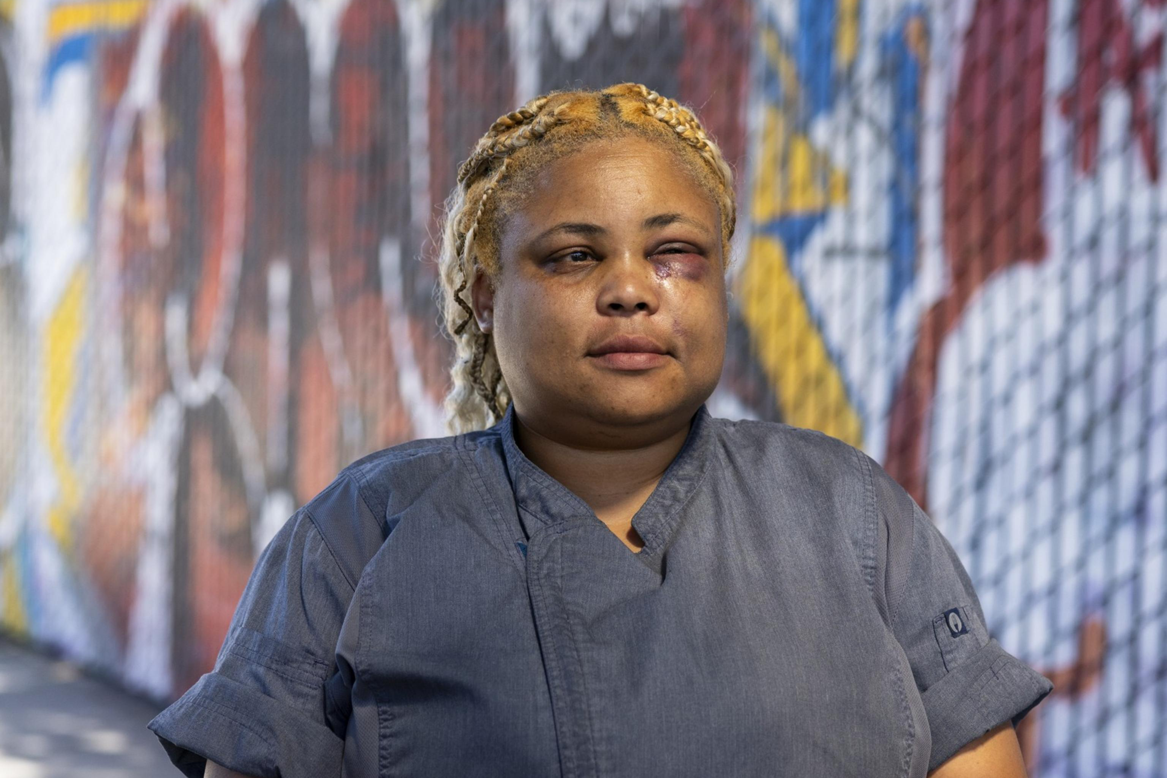 A person with braided hair and a facial bruise stands in front of a colorful graffiti-covered fence, wearing a gray short-sleeve shirt and a red watch.