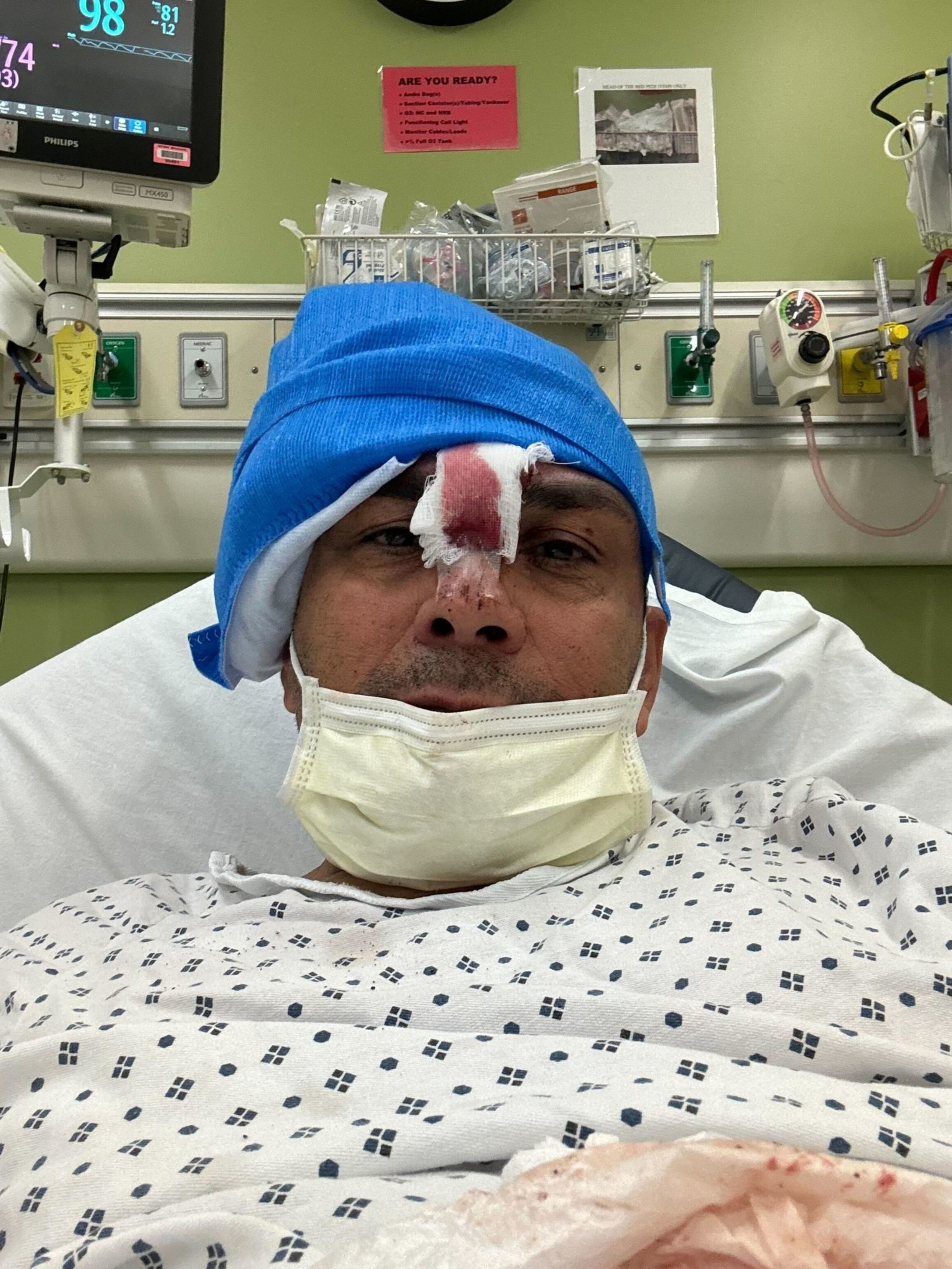 A person in a hospital gown and a blue surgical cap has a bandaged nose and wears a mask. Medical equipment is in the background.
