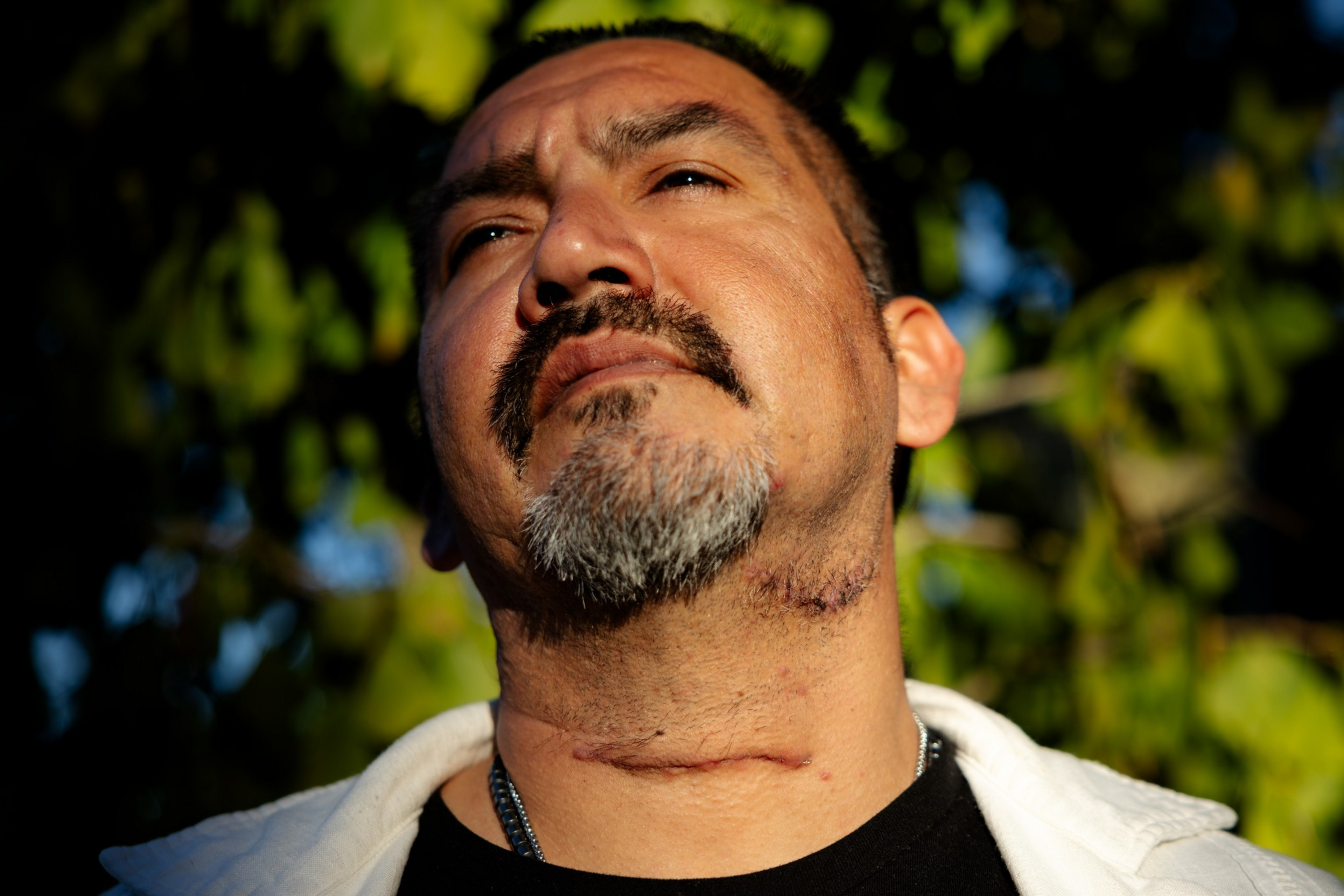 A man with a trimmed beard and mustache gazes upward, showing fresh scars on his neck, with blurred green foliage in the background.