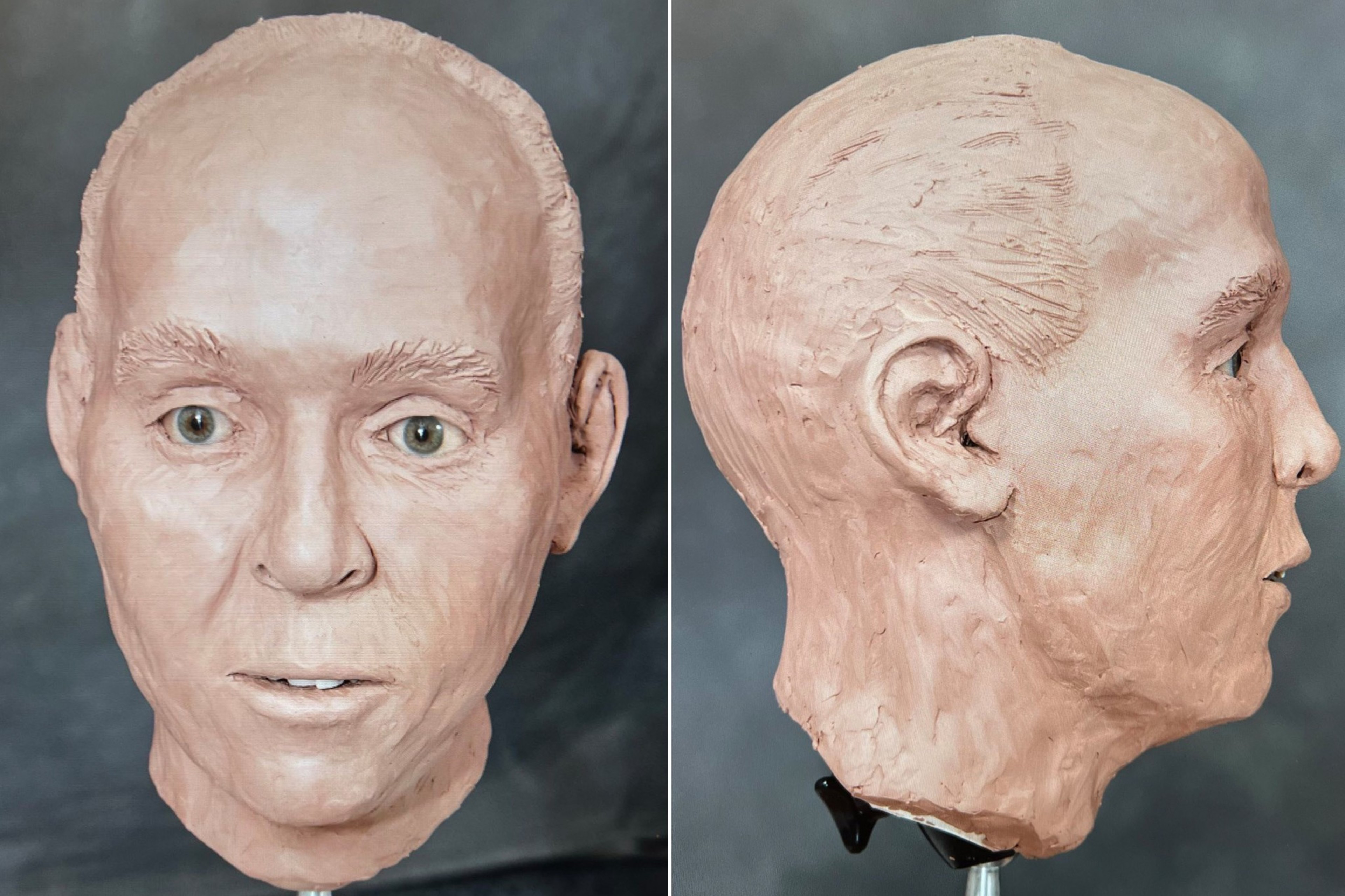 The missing skull is seen in a cast.