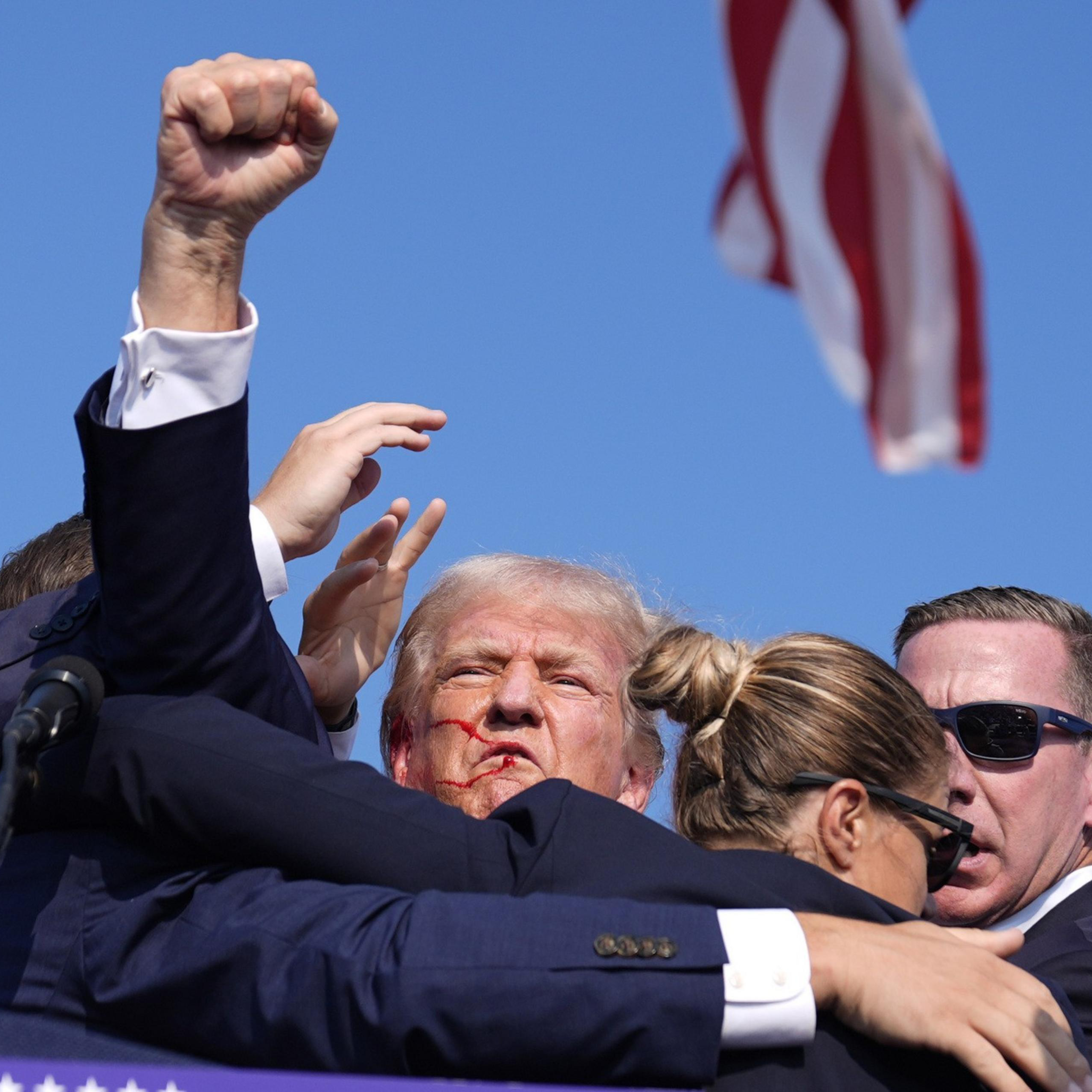 A group of people surrounds a man with a scraped face, raising a fist against a clear blue sky. An American flag is in the background, and security personnel are present.