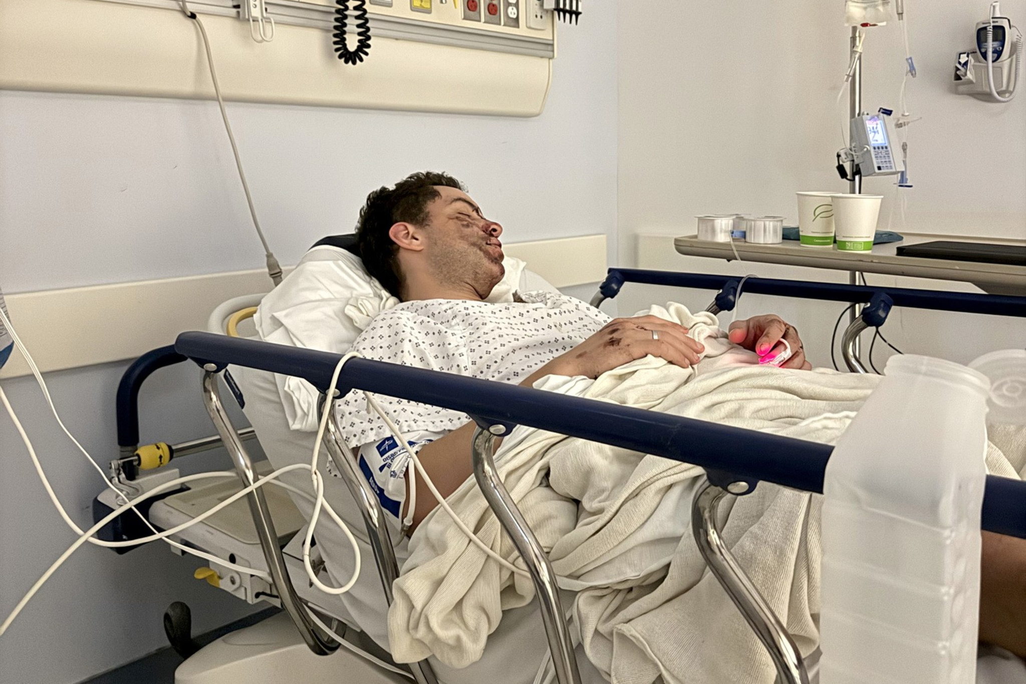 A man lies on a hospital stretcher with an IV drip, wearing a hospital gown, covered by a blanket, resting in a clinical room.