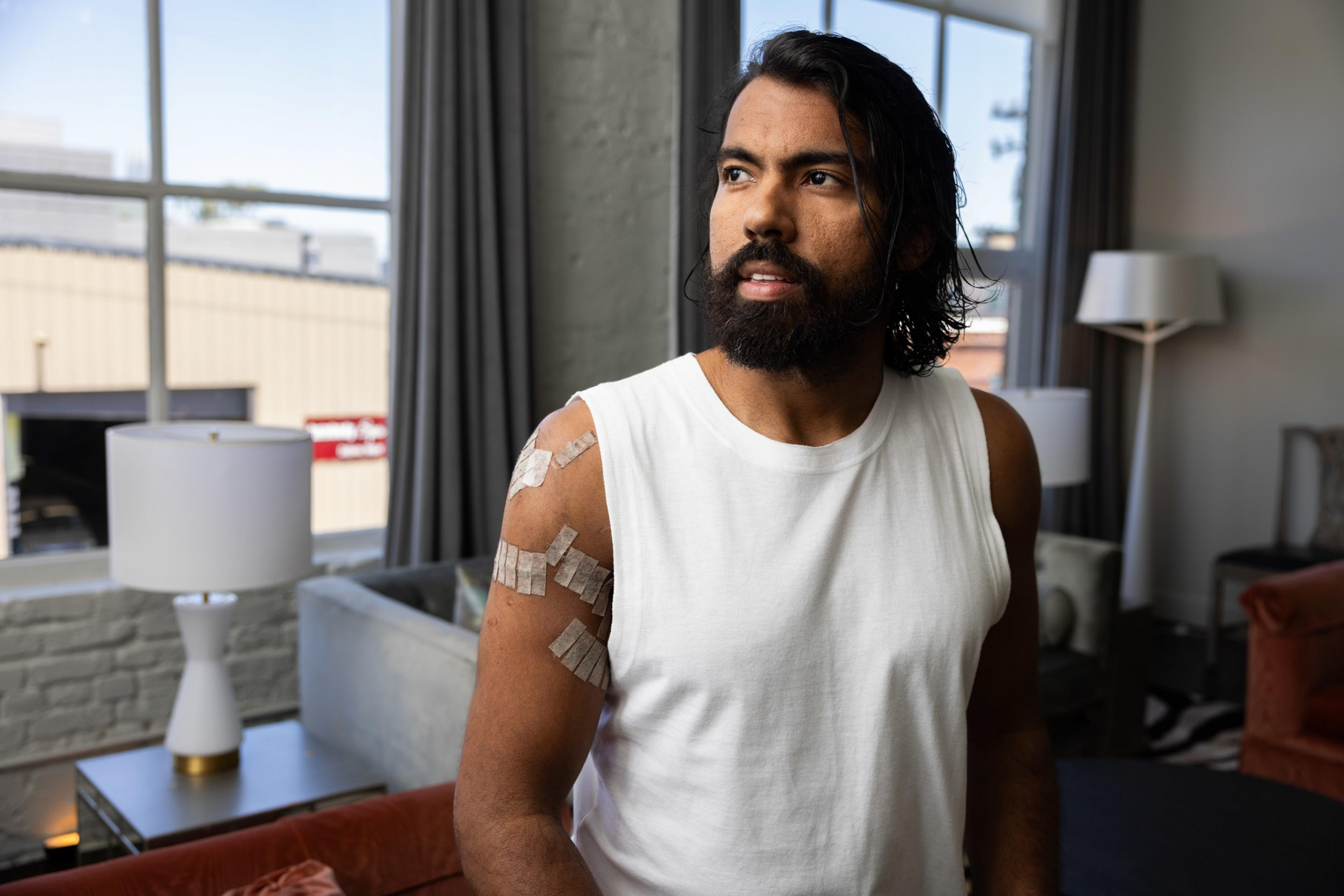 A bearded man with long hair and a white sleeveless shirt has several bandages on his arm. He stands indoors, next to a window with grey curtains.