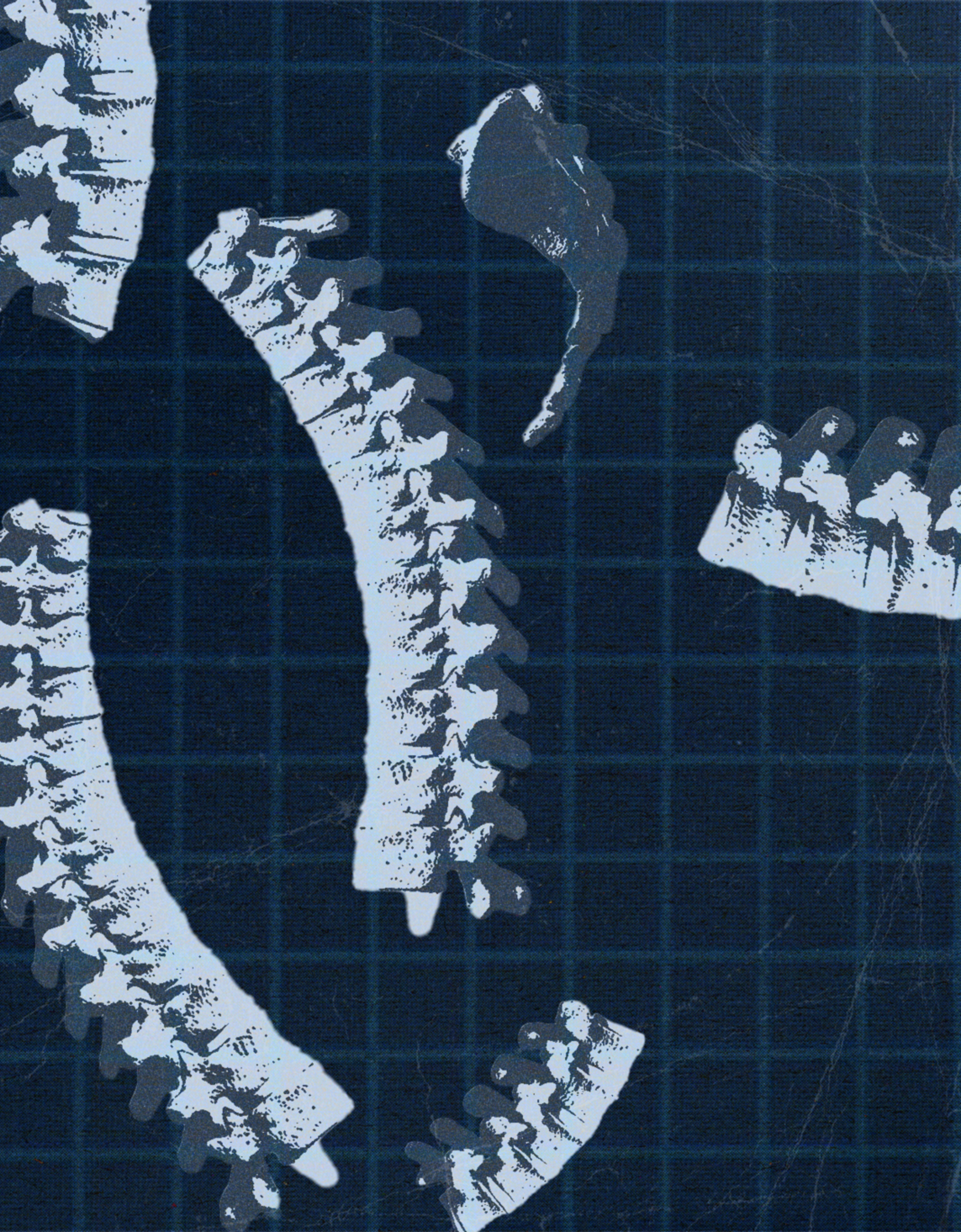 A photo collage of bones.