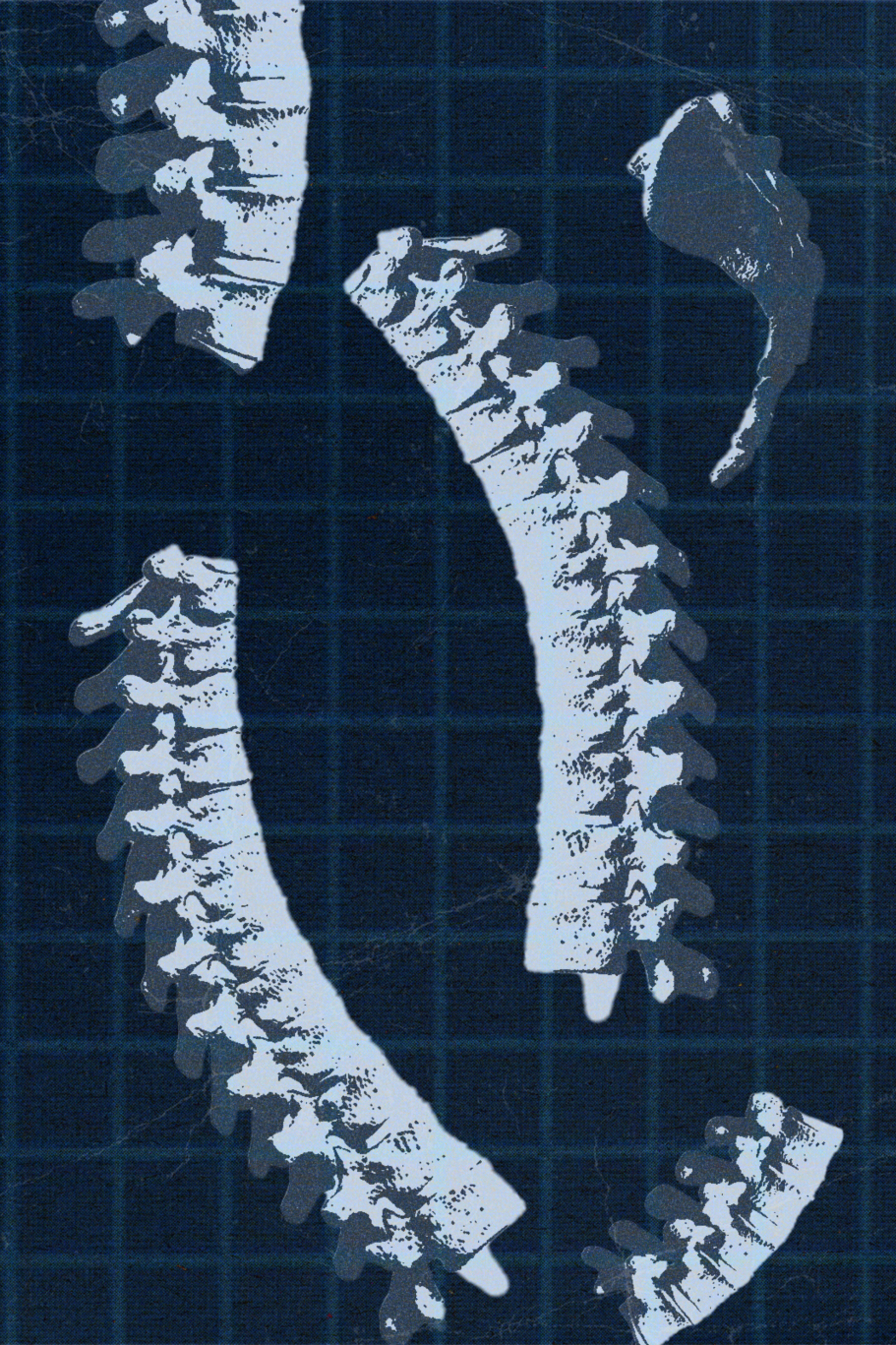 A photo collage of bones.
