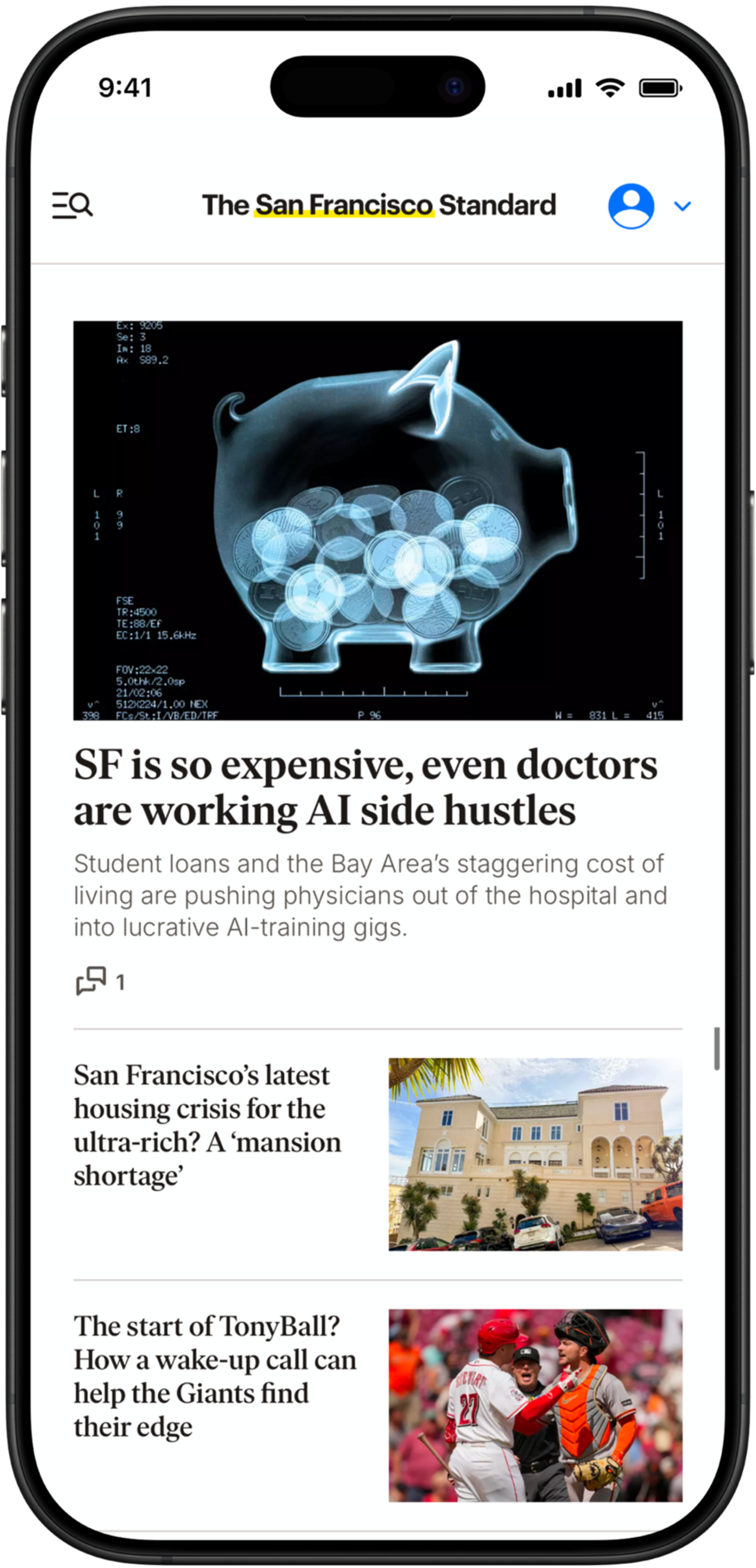 An X-ray image of a piggy bank filled with coins accompanies a headline about San Francisco doctors working AI side hustles due to high living costs.